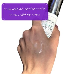 سرم میکرونیدلینگ ریدل شات 300