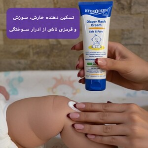کرم سوختگی پای کودک هیدرودرم