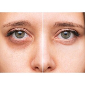 سرم دور چشم کافئین ژنوبایوتیک 30ml