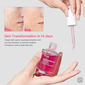 سرم ضد لک آنوا حاوی نیاسینامید 10% و ترانگزامیک اسید 4%