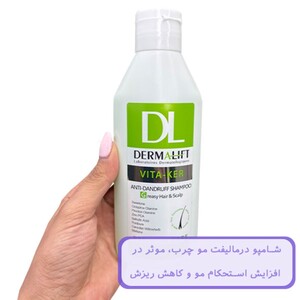 شامپو ضد شوره موهای چرب ویتاکر درمالیفت