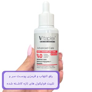تونیک تقویت کننده مو پس از کاشت ویتاپلکس