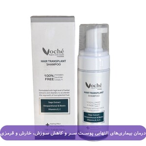 شامپو موهای کاشته شده وچه 150ml