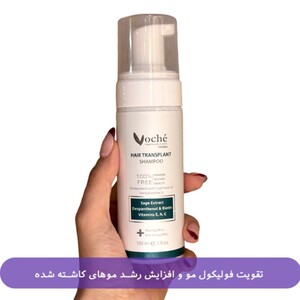 شامپو موهای کاشته شده وچه 150ml