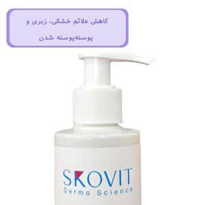 لوسیون بدن حاوی اوره 10% اسکوویت
