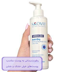 لوسیون بدن حاوی اوره 10% اسکوویت