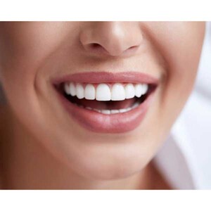 دهانشویه میسویک مناسب دندان دارای جرم 200ml