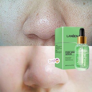 چسب لاکی بینی ضدجوش و پاک کننده مدل لانبنا (Lanbena)