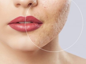 ۵ اشتباه رایج در شستن صورت که آکنه را تشدید می‌کنند