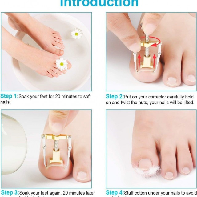 ارتودنسی ناخن