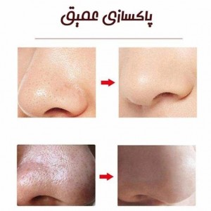 میکرودرم حرفه ایGlowish style