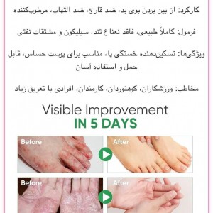 اسپری گیاهی ضد بوی پا