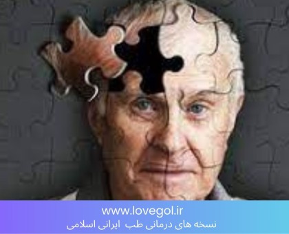 کند کردن روند آلزایمر