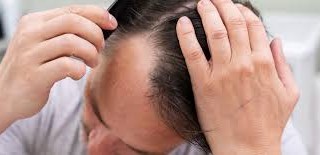 روش های درمان خشکی مو با ماسک خانگی