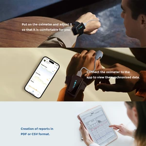 پالس اکسیمتر مچی هوشمند