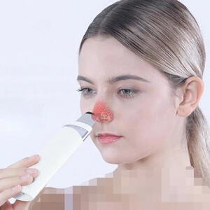 دستگاه پاکسازی پوست کا. اسکاین