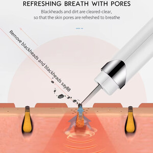 بهترین دستگاه پاکسازی پوست کا. اسکاین