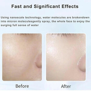 دستگاه فیشیال آبرسان و مرطوب کننده پوست ام دی اچ ال
