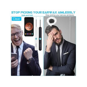 دستگاه آندوسکوپی و پاک کننده داخل گوش شیائومی Xiaomi Bebird R1 Smart Visual Ear Sticks Endoscope