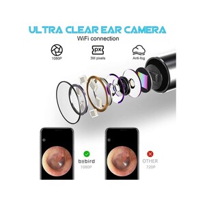 دستگاه آندوسکوپی و پاک کننده داخل گوش شیائومی Xiaomi Bebird R1 Smart Visual Ear Sticks Endoscope