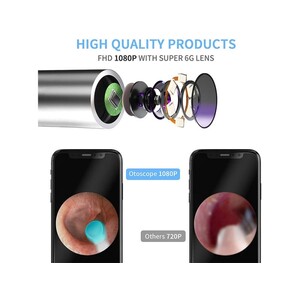 دستگاه آندوسکوپی و پاک کننده داخل گوش شیائومی Xiaomi Bebird R1 Smart Visual Ear Sticks Endoscope