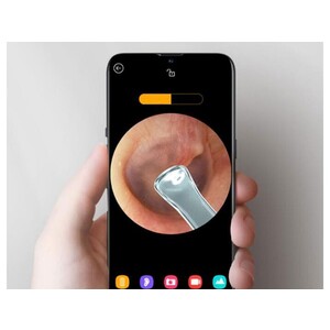 دستگاه آندوسکوپی و پاک کننده داخل گوش شیائومی Xiaomi Bebird R1 Smart Visual Ear Sticks Endoscope