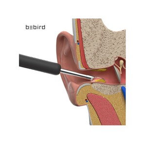 دستگاه آندوسکوپی و پاک کننده داخل گوش شیائومی Xiaomi Bebird R1 Smart Visual Ear Sticks Endoscope