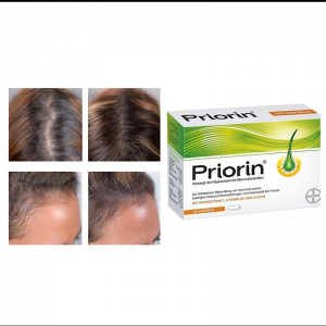مکمل مو پریورین 30 عددی به‌صورت ورقی (Priorin Hair Growth Capsules 30 Tablets)
