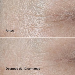 کرم دور چشم کلینیک اسمارت کلینیکال ریپر Clinique Smart Clinical Repair Wrinkle Correcting Eye Cream