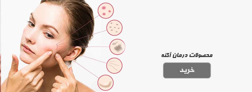  درمان آکنه