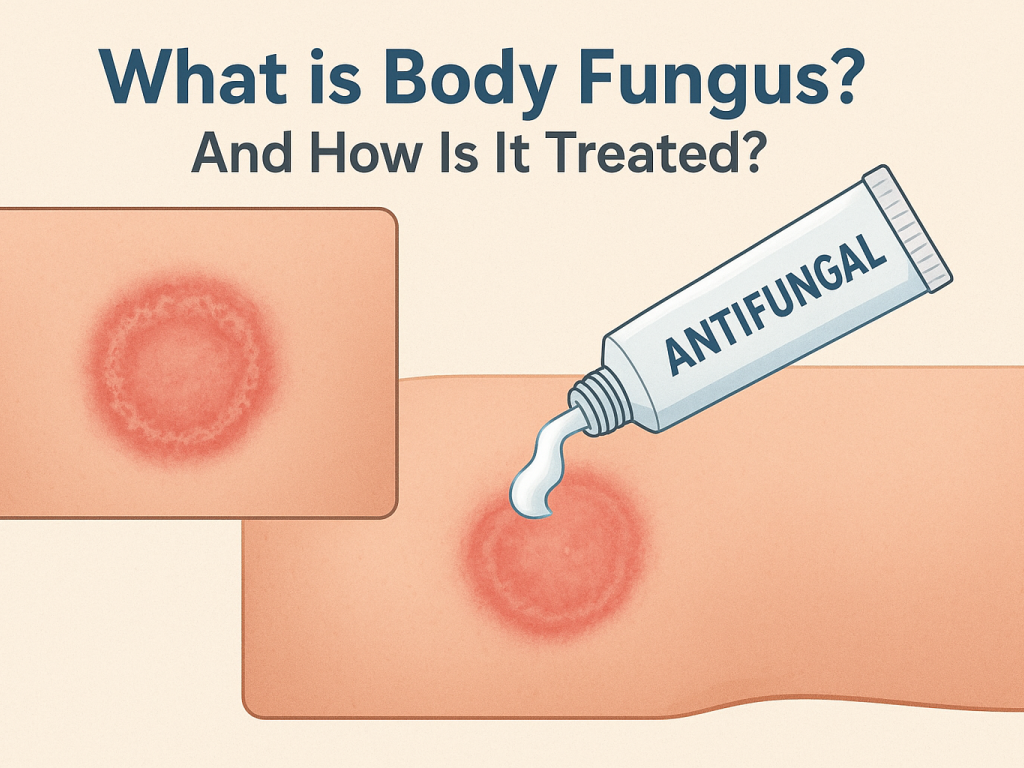 قارچ بدن چیست و چگونه درمان می‌شود؟ معرفی بهترین کرم ضد قارچ و لینک خرید از ترب