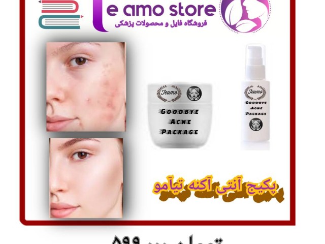 پکیج آنتی آکنه تیآمو 100% تضمینی