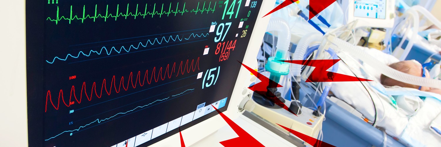 اگر مانیتور علائم حیاتی شما هر چند دقیقه یکبار بی‌ دلیل آلارم می‌دهد، این ۳ علت را حتما بررسی کنید!