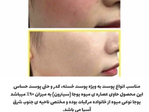 ژل کرم مرطوب و روشن کننده یوجا نیاسین سام بای می