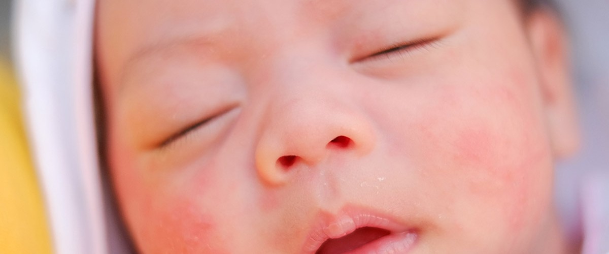 راهکار های مفید برای مقابله با خشکی پوست نوزادان