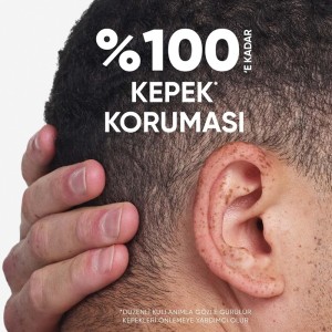 خرید و قیمت Head & Shoulders Arindirma Parlaklik 330ml