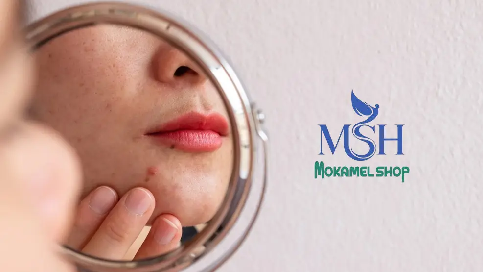 تاثیر مکمل های بدنسازی بر پوست