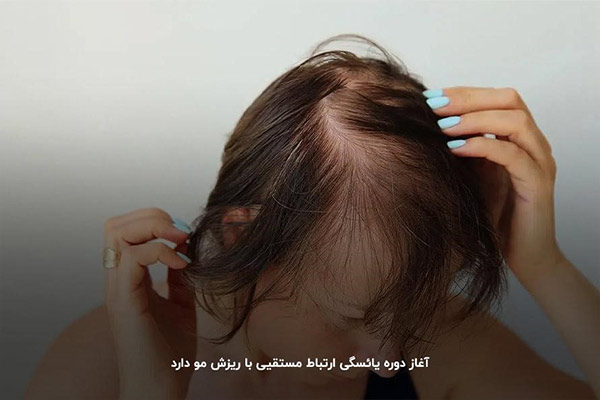 یائسگی؛‌ مهم‌ترین علت ریز مو در زنان میانسال