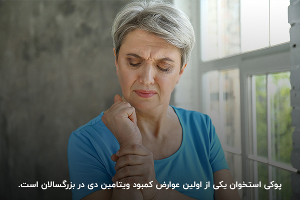 پوکی استخوان و درد مفاصل؛ یکی از علائم کمبود ویتامین دی در زنان پس از یائسگی