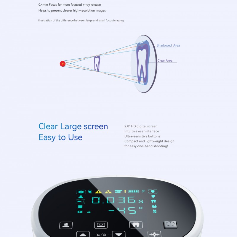 رادیوگرافی پرتابل ووددپکر Miniray