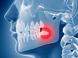 آشنایی با مراحل جراحی دندان عقل