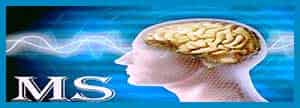 اثر امواج الکترومغناطیس و تشدید بیماری مالتیپل اسکلروزیس (MS) (مطلب)