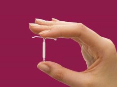 آیودی میرنا  IUD MIRENA