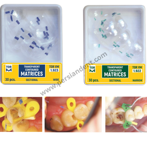 سکشنال شفاف TORVM