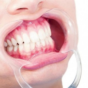 دهان بازکن دو طرفه نعلی شکل C shape  Double Head Cheek Retractor