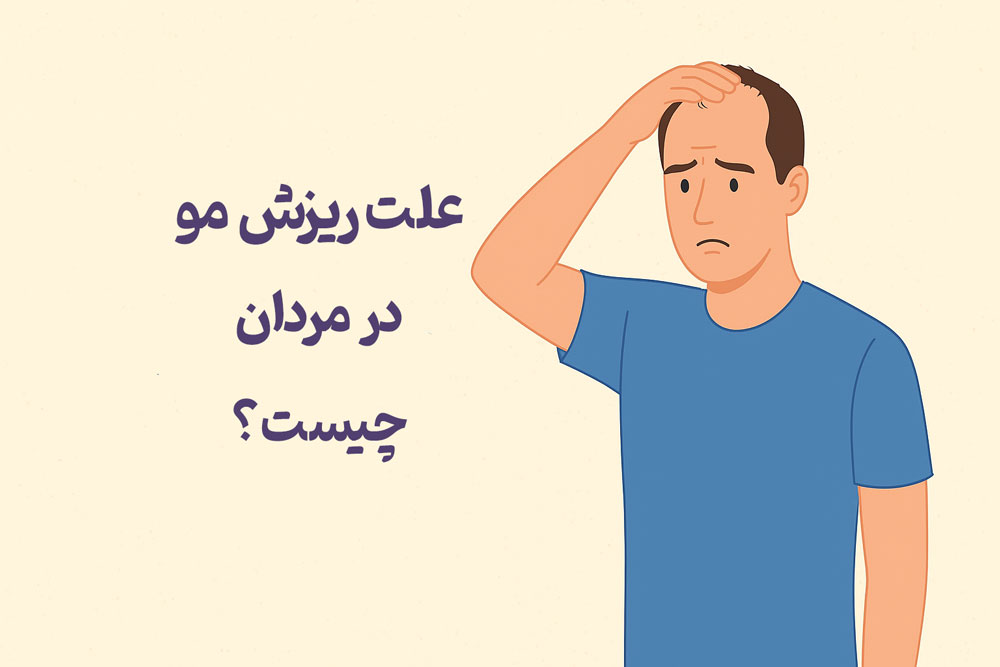علت ریزش مو در مردان چیست؟