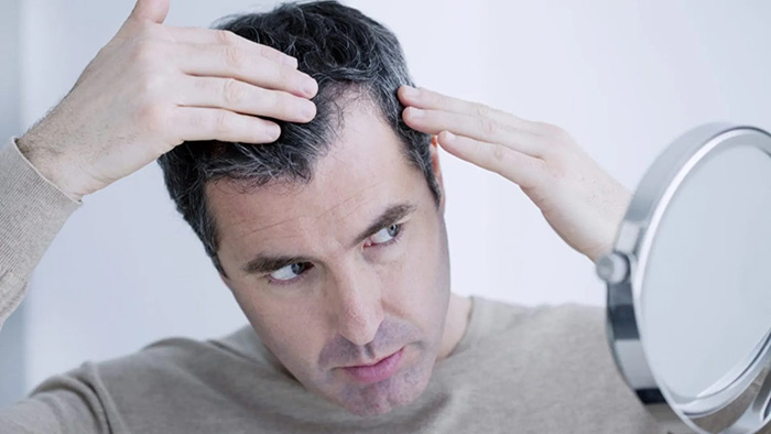 علت نازک شدن مو چیست؟ بررسی کامل دلایل، نشانه ها و روش های تقویت مو