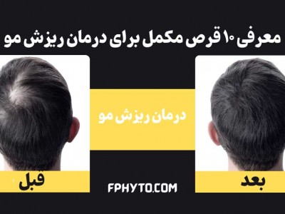 معرفی 10 قرص مکمل برای درمان ریزش مو
