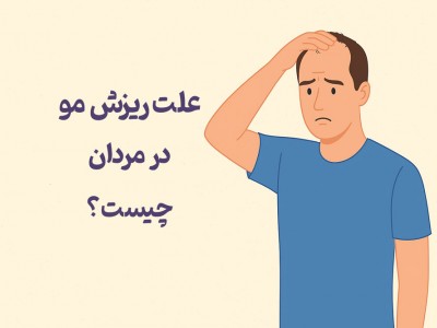 علت ریزش مو در مردان چیست؟