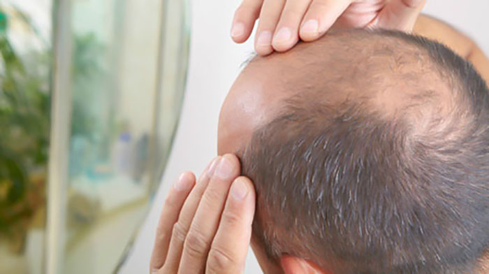فاکتورهای حیاتی برای دستیابی به بهترین نتیجه